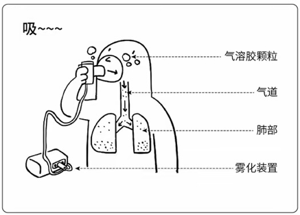 呼吸机雾化器连接图图片